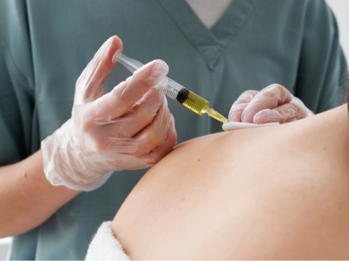 L’hydrotomie percutanée