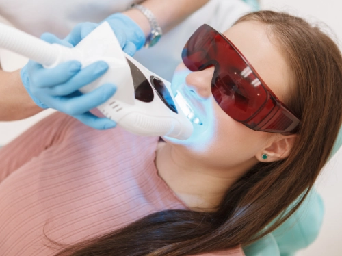 Blanchiment dentaire